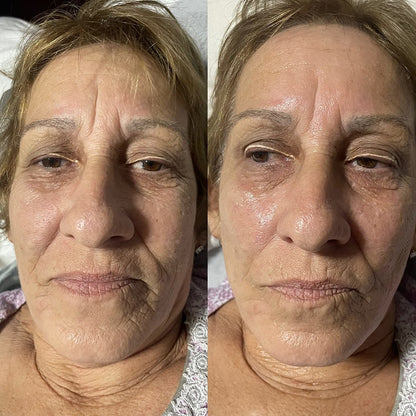 Microcurrent Facial Massager
